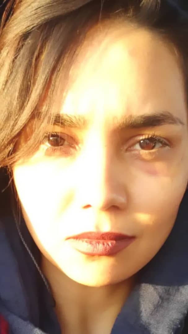 آتوسا عیوبی